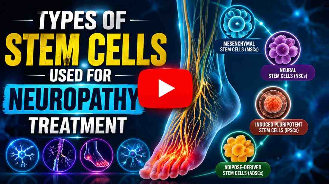 Types Of Stem Cells Used For Neuropathy Treatment